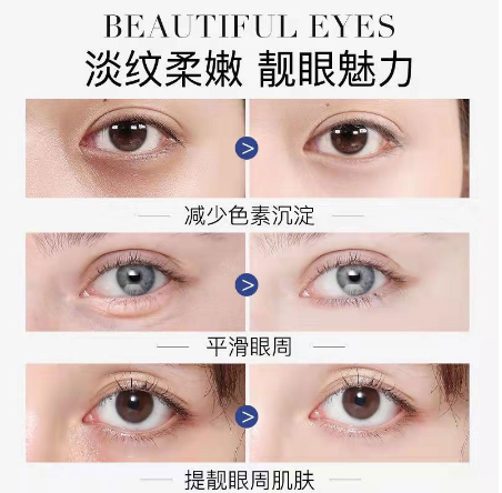 台灣熱銷【眼部救星棒】熱熔霜  急救眼部肌膚問題！KO眼袋·眼紋·眼腫·黑眼圈，連笑容紋都可以一拖即平