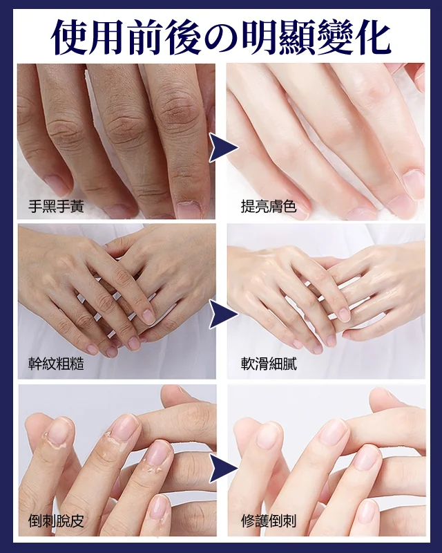 【白到發光】防乾裂美白護手霜 細嫩美白 真美白 有特證 即刻水潤嫩白，解救乾裂粗糙手！