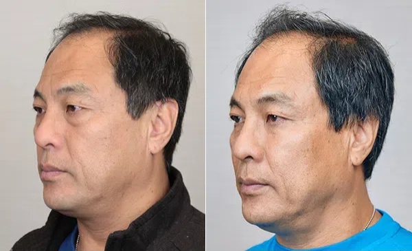 1743070958651248.jpg 10009.jpg